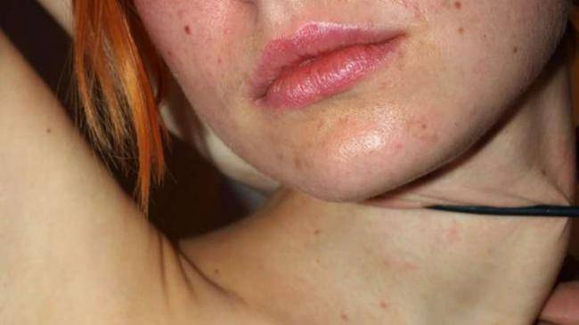 Qardaş bacısını kəndirlə boğaraq öldürdü