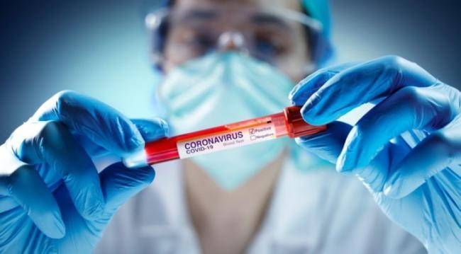 Koronavirus Azərbaycanın hansı bölgəsində daha çox yayılıb? -