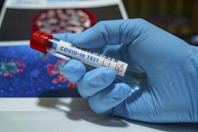 Azərbaycanda virusa yoluxanların sayı kəskin artdı: Daha 4 nəfər öldü