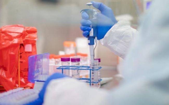 Azərbaycanda daha bir tibb işçisi koronavirusdan öldü