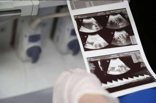 Bakıda özəl klinikada bakirə qızı nişanlısının yanında...