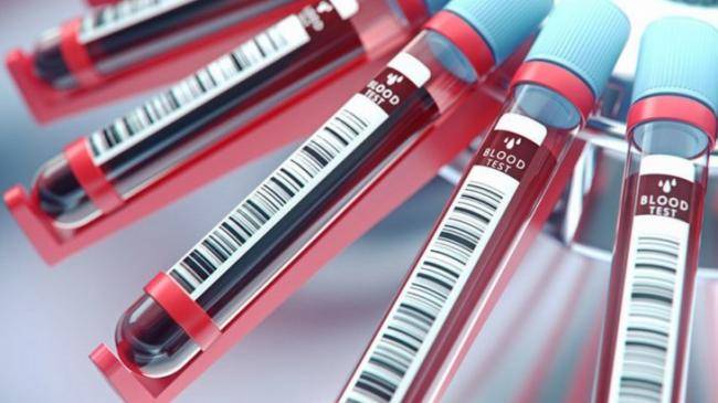 Koronavirusu təyin etməyin ən sadə yolunu açıqladı -