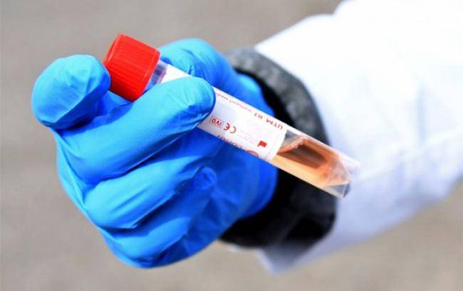 Azərbaycanda koronavirus sayında yeni rekord