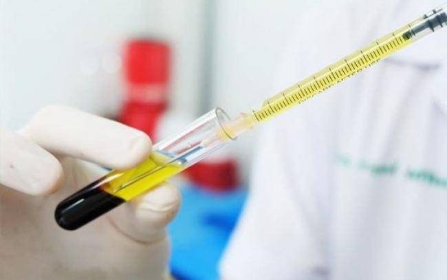 TƏBİB seroloji testlər keçirəcək