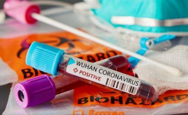 ÜST-dən koronavirusla bağlı ŞOK XƏBƏRDARLIQ: