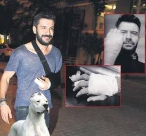 Aktyorun əlini it parçalayıb Xəbər şəkili