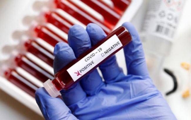 Türkiyədə koronavirusa yoluxanların sayı 260 mini keçdi