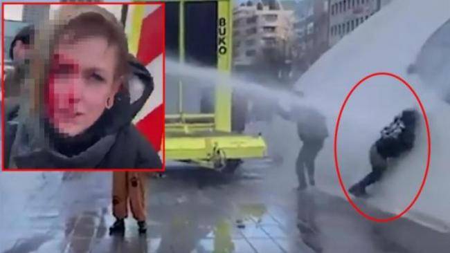 Polis elə bir hərəkət etdi ki, qadının kəllə sümüyü çatladı -