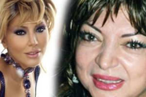 Lalə Dadaşova tanınmaz halda - FOTO Xəbər şəkili