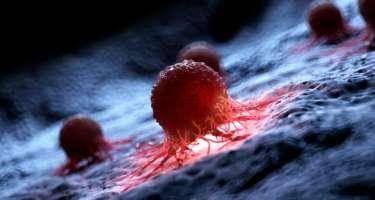 Ən ölümcül xərçəng növü açıqlandı