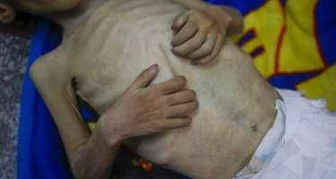 Qəzzada aclıqdan ölənlərin sayı açıqlandı