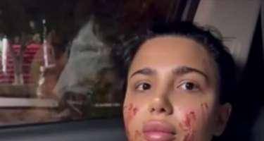 Qadına hücum etdiyi deyilən sabiq məmur nəvəsi saxlanıldı