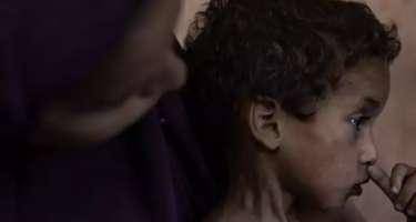 Qəzzada 86 nəfər aclıqdan vəfat edib