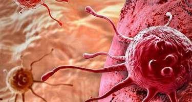 Xərçəng olmamaq üçün bunları edin