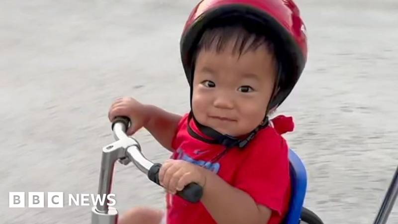 Nadir Hunter Sindromundan Əziyyət Çəkən 3 Yaşlı Uşaq Gen Terapiyası Sayəsində Həkimləri Heyrətə Gətirdi