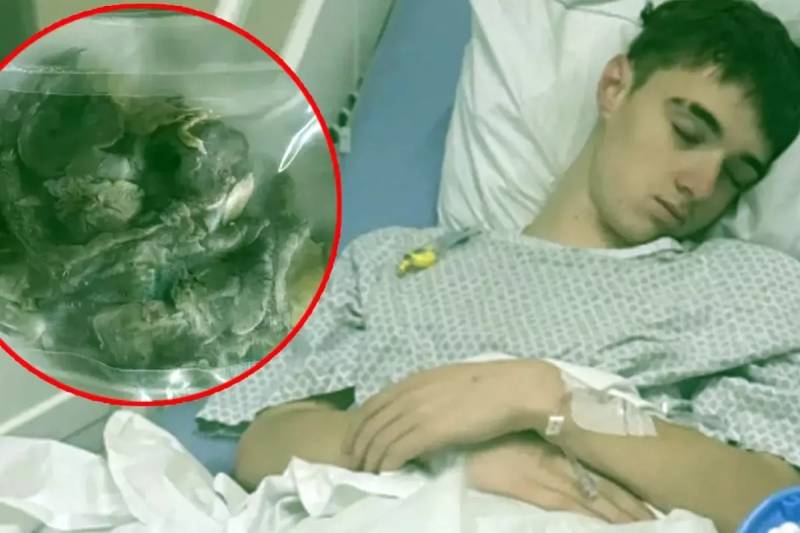 Elektron Siqaret Dəhşəti: Gəncin Ağciyəri Çökdü və Qismən Kəsilərək Çıxarıldı Xəbər şəkili